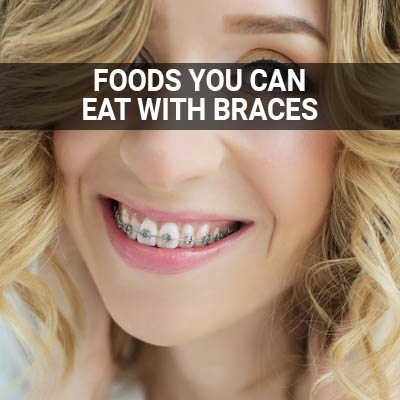 Navigation image for our Foods You Can Eat With Braces page